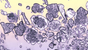 Scoperto nanocorpo capace di neutralizzare i virus mortali Hendra e Nipah