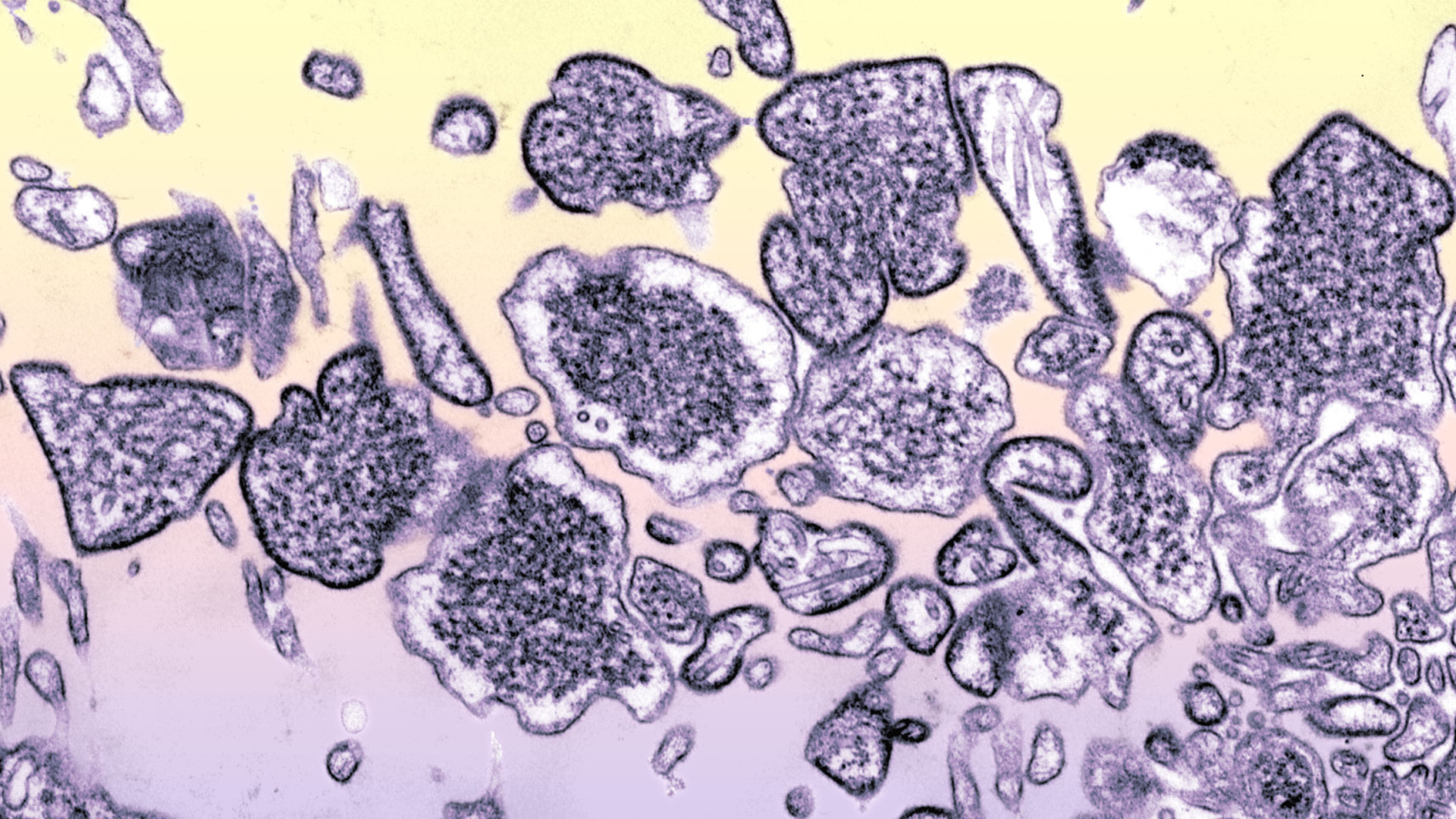 Scoperto nanocorpo capace di neutralizzare i virus mortali Hendra e Nipah